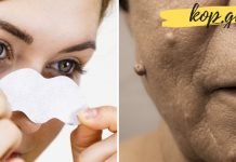 მოიცილეთ მეჭეჭები, მუქი ლაქები და ფორები მარტივი მეთოდებით.