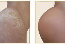 ეს საიდუმლო პედიკურის სალონებს ხურავს! – გაიჯანსაღეთ ფეხის კანი სახლში 10 წუთში და დაზოგეთ ფული