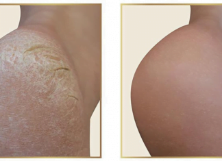 ეს საიდუმლო პედიკურის სალონებს ხურავს! – გაიჯანსაღეთ ფეხის კანი სახლში 10 წუთში და დაზოგეთ ფული