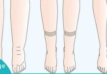 ორგაზნიშმი ზედმეტი სითხის მოსაშორებელი 9 მეთოდი-აირიდეთ შეშუპების პრობლემა!