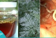 როგორ გავთავისუფლდეთ მუცლის ჭიებისგან – ეს ნატურალური საშუალებები დაგეხმარებათ!