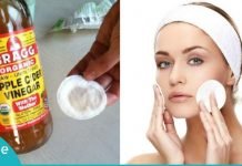 აი რა სარგებლობა მოაქვს ვაშლის ძმარს ჩვენი ჯანმრთელობისთვისა და სილამაზისთვის!