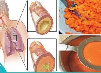 ორინგრედიენტიანი სიროფი, რომელიც ხველას მოგიხსნით და ფილტვებიდან ლორწოს გააქრობს!