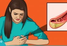 გაისუფთავეთ არტერიები მარტივად- სცადეთ საოცრად ეფექტური სასმელი