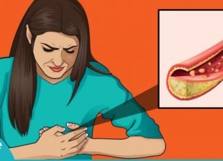 გაისუფთავეთ არტერიები მარტივად- სცადეთ საოცრად ეფექტური სასმელი