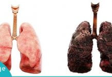 სასმელი, რომელიც ყველა მწეველმა უნდა დალიოს! გადაარჩინეთ ფილტვები