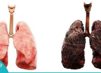 სასმელი, რომელიც ყველა მწეველმა უნდა დალიოს! გადაარჩინეთ ფილტვები