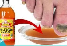 აი რისთვის იყენებს ის ვაშლის ძმარს. ასეთ შედეგს ნამდვილად არ ველოდი!