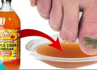 აი რისთვის იყენებს ის ვაშლის ძმარს. ასეთ შედეგს ნამდვილად არ ველოდი!