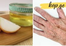 თუ ხელებზე გაქვთ ყავისფერი ლაქები, მაშინ ეს უნდა სცადოთ