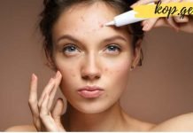 6 შინაგანი პრობლემა, რამაც შეიძლება გამოიწვიოს სახეზე გამონაყარი!