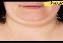 როგორ მოვიშოროთ ღაბაბი ნატურალური ინგრედიენტების გამოყენებით სწრაფად- ეფექტური მეთოდი