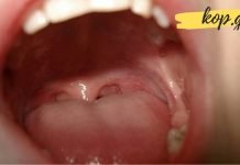 როგორ მოვიშოროთ უსიამოვნო სუნი პირის ღრუდან? ყველაზე ეფექტური მეთოდი რაც გსმენიათ