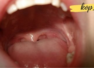 როგორ მოვიშოროთ უსიამოვნო სუნი პირის ღრუდან? ყველაზე ეფექტური მეთოდი რაც გსმენიათ