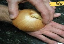 ჯანმრთელობასთან დაკავშირებული 5 პრობლემა, რომელსაც ხახვის დახმარებით გადაჭრით