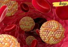 თუ სისხლში მაღალი ქოლესტერინი გაქვთ, მაშინ ეს საშუალებები უნდა მიიღოთ