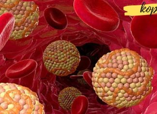 თუ სისხლში მაღალი ქოლესტერინი გაქვთ, მაშინ ეს საშუალებები უნდა მიიღოთ