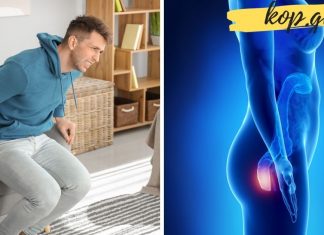 ბუასილის მკურნალობა ბუნებრივი მეთოდებით. ის რაც აქამდე არ იცოდით