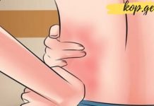 ამ ვიტამინის ნაკლებობა ზურგის და სახსრების ტკივილს იწვევს– საჭირო ინფორმაციაა!