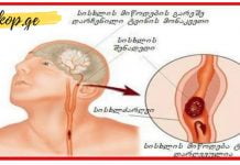 ყველამ წაიკითხეთ! ეს ძალიან მნიშვნელოვანი და მარტივი დასამახსოვრებელი ტექსტი…