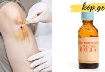 იოდის ბადე: მარტივი ხაზების სამკურნალო თვისებები