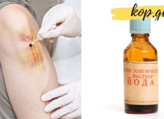 იოდის ბადე: მარტივი ხაზების სამკურნალო თვისებები