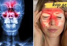 თუ სინისუტის აუტანელი ტკივილები გაწუხებთ, მაშინ ეს უნდა გააკეთოთ