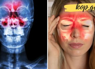 თუ სინისუტის აუტანელი ტკივილები გაწუხებთ, მაშინ ეს უნდა გააკეთოთ