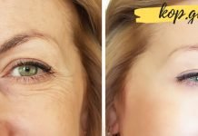 როგორ მოვიშოროთ სახიდან ნაოჭები? ეს ნამდვილად დაგეხმარებათ