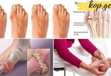 რა უნდა გავაკეთოთ იმისთვის, რომ სახლის პირობებში მოვიშოროთ ზედმეტი მარილები სხეულიდან?