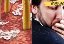 თუ ქერტლი გაქვთ და არ იცით როგორ მოიშოროთ, მაშინ ეს უნდა წაიკითხოთ