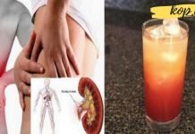 გემრიელი და სასარგებლო სასმელი თირკმელებში კენჭების წინააღმდეგ. ეფექტურია