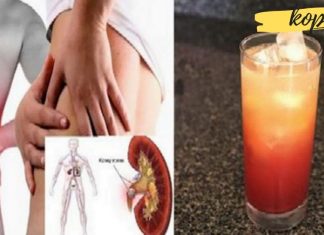 გემრიელი და სასარგებლო სასმელი თირკმელებში კენჭების წინააღმდეგ. ეფექტურია