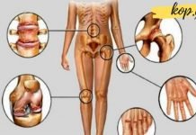 სამი ყველაზე ეფექტური საშუალება სახსრების ტკივილის წინააღმდეგ. საჭირო ინფორმაციაა