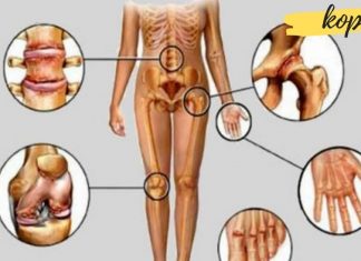 სამი ყველაზე ეფექტური საშუალება სახსრების ტკივილის წინააღმდეგ. საჭირო ინფორმაციაა