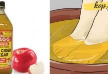 მან ფეხები ვაშლის ძმარში ჩაყო. ასეთ შედეგს ნამდვილად არ ველოდი!