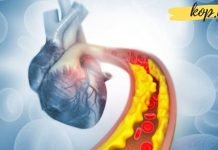 მაღალი ქოლესტერინის 9 სიმპტომი, რომლის უგულებელყოფაც არ შეიძლება!!