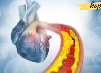 მაღალი ქოლესტერინის 9 სიმპტომი, რომლის უგულებელყოფაც არ შეიძლება!!