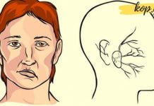 არატრადიციული მეთოდი, რომელიც ადამიანს ინსულტის დროს შველის. საინტერესო ხერხია