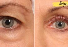 ეს საშუალებები დაგეხმარებათ თვალის მიდამოს გაახალგაზრდავებაში. უნდა სცადოთ