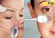 სახის კანის გაახალგაზრდავება 10 დღეში ჩვეულებრივი კოვზის დახმარებით. ეს რეალურია!