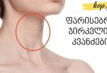 ფარისებრ ჯირკვალში კვანძები გაგიჩნდათ? ჩვენ მათი მკურნალობის ნატურალურ გზებს გთავაზობთ