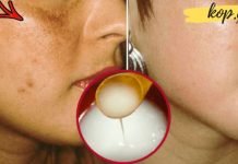 გაანათეთ და გააუმჯობესეთ კანის მდგომარეობა ეფექტური შინ დამზადებული კრემით. შედეგი საოცარია!