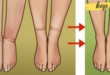 როგორ გაუმკლავდეთ შეშუპებას სხეულში სითხის შეკავების გამო?! ძალიან სასარგებლო ინფორმაცია