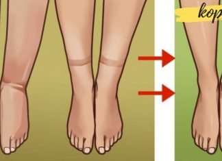 როგორ გაუმკლავდეთ შეშუპებას სხეულში სითხის შეკავების გამო?! ძალიან სასარგებლო ინფორმაცია