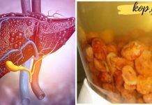 მეცნიერებმა აღმოაჩინეს ღვიძლის გაწმენდის საუკეთესო გზა!