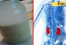 როგორ გამოვდევნოთ თირკმელებიდან კენჭები 15 დღეში? ეს საოცარი მასალა დაგეხმარებათ ამაში!