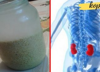 როგორ გამოვდევნოთ თირკმელებიდან კენჭები 15 დღეში? ეს საოცარი მასალა დაგეხმარებათ ამაში!