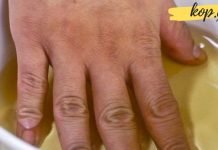 ვაშლის ძმარი სახსრების ტკივილის წინააღმდეგ! აუცილებლად უნდა სცადოთ!