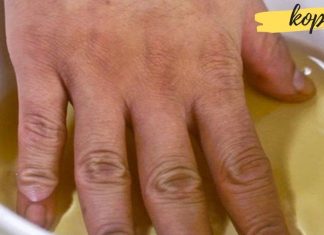 ვაშლის ძმარი სახსრების ტკივილის წინააღმდეგ! აუცილებლად უნდა სცადოთ!